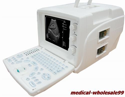 USB CE proved portable ultrasound scanner+convex probe USB port low 